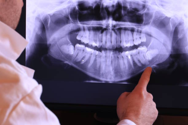 Best Emergency Wisdom Teeth Removal in North Little Rock, AR